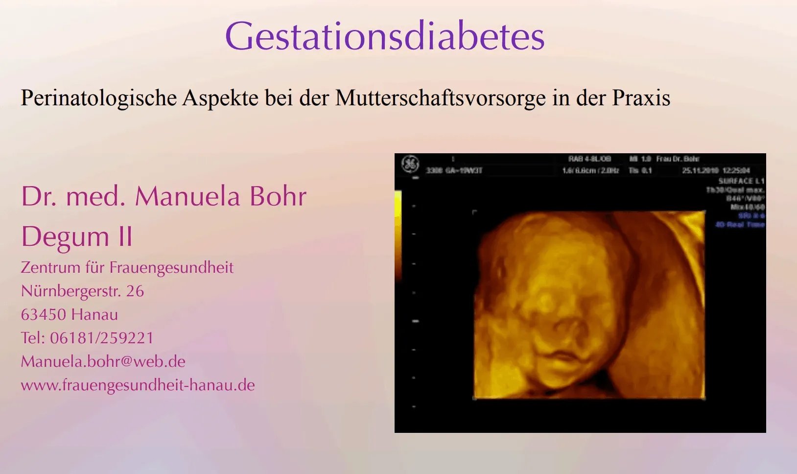 2012-04-04+Pr-C3-A4sentation+Gestationsdiabetis+Kliniken+Hanau+-+Manuela+Bohr-1920w-1920w